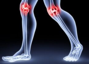 The reasons for the development of knee osteoarthritis